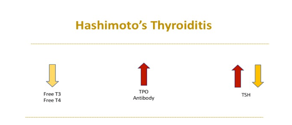 Primary lab markers used to diagnose Hashimoto's.