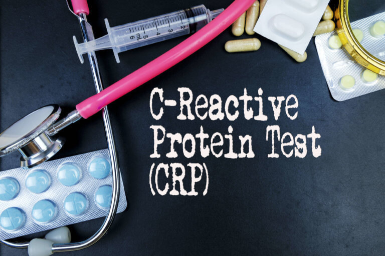 C-Reactive Protein Test