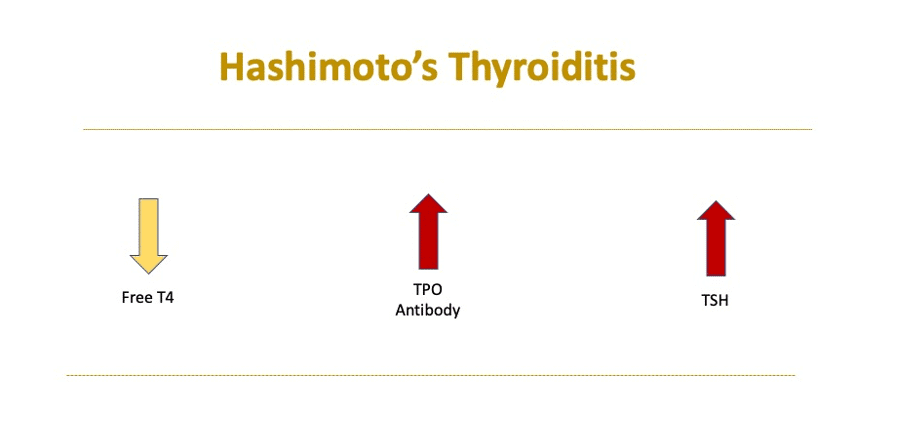 How to read test for Hashimoto's disease