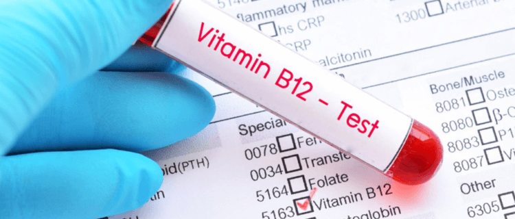 Vitamin B12 blood test