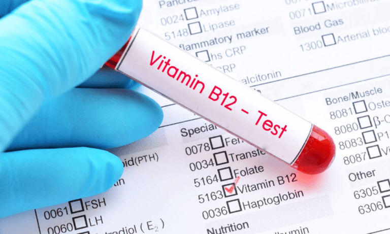 Vitamin B12 blood test