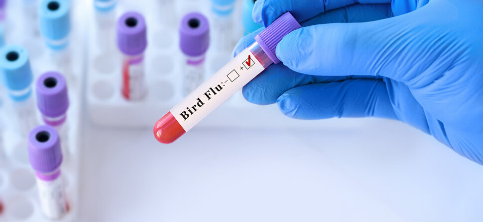 Bird Flu - Lab test